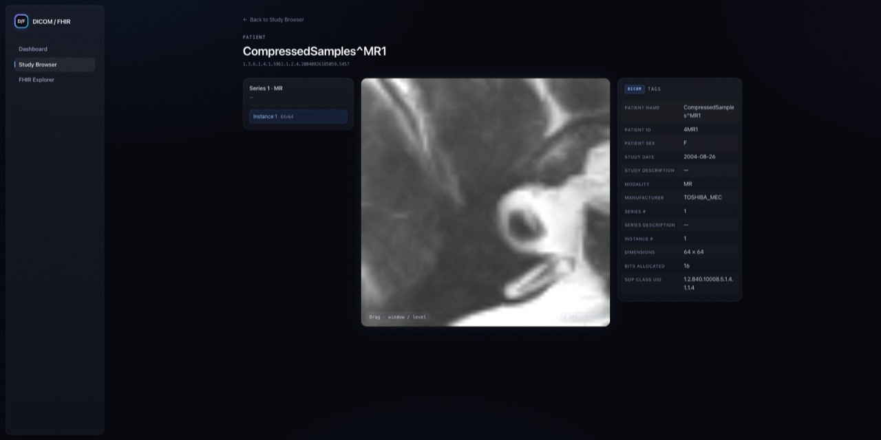 dicom-fhir-viewer — screenshot of the live app
